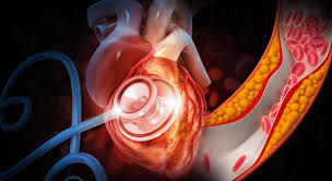 카무트 효소 효능 6가지 부작용 먹는법 호라산 밀