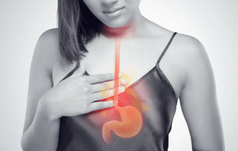 역류성 식도염 증상 10가지, 자연치료 방법
