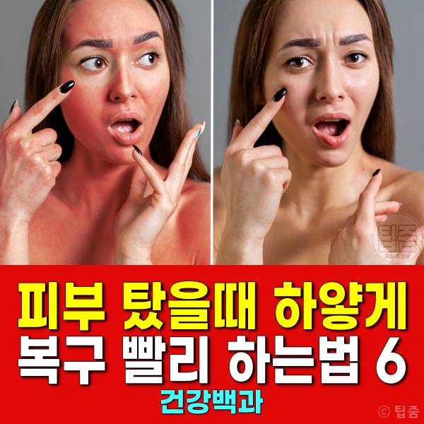 피부 탔을때 하얗게 얼굴 탄거 복구