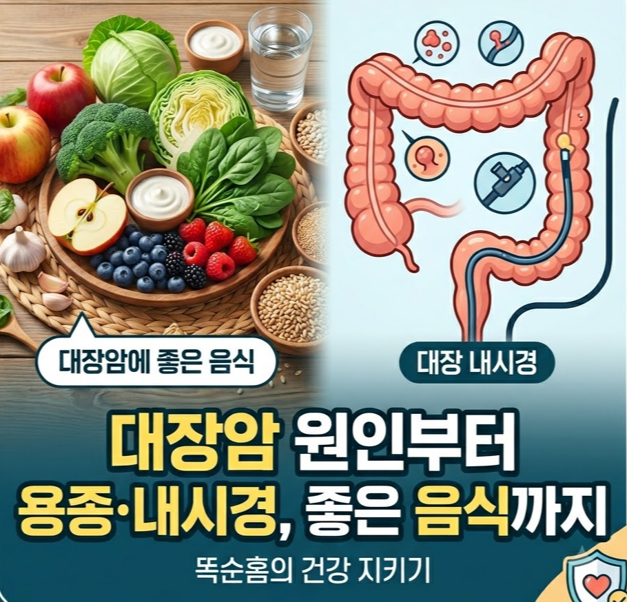 대장암 예방을 위한 건강한 식단과 대장 내시경 용종 절제 검사를 설명하는 똑순홈 블로그 썸네일 이미지
