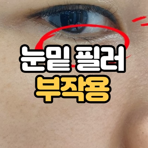 눈밑필러 부작용