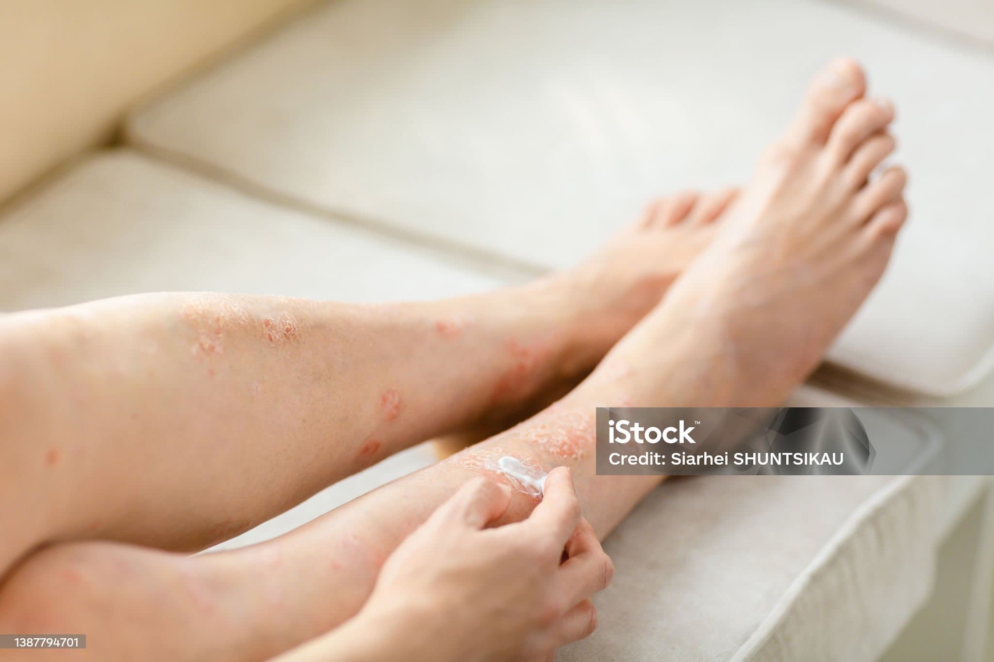 다리가 가려운 이유 무엇일까