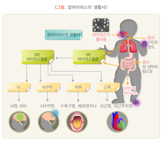 수족구병 증상 및 예방법
