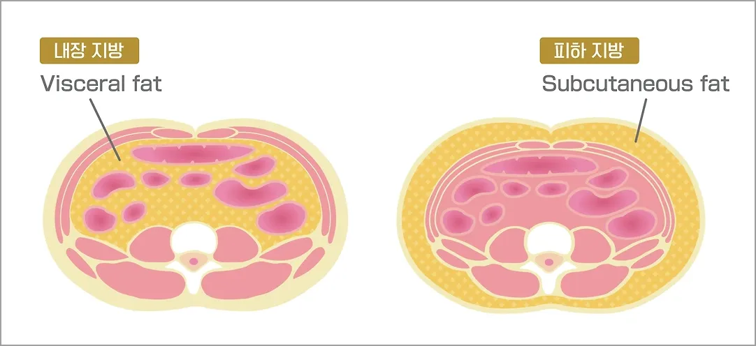 내장지방과-피하지방이-생기는-위치-설명