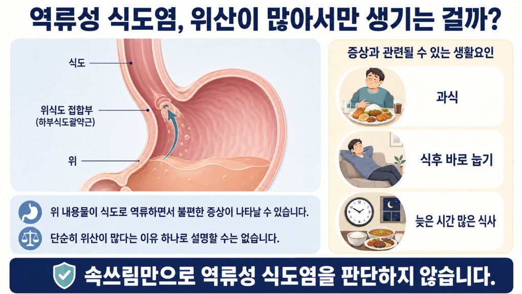 위 내용물이 식도로 역류하는 모습과 역류성 식도염의 발생 과정을 설명한 이미지
