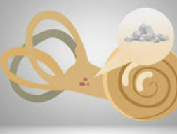 이석증 증상 원인 자가치료법 치료 등 총정리 (24년 Ver)