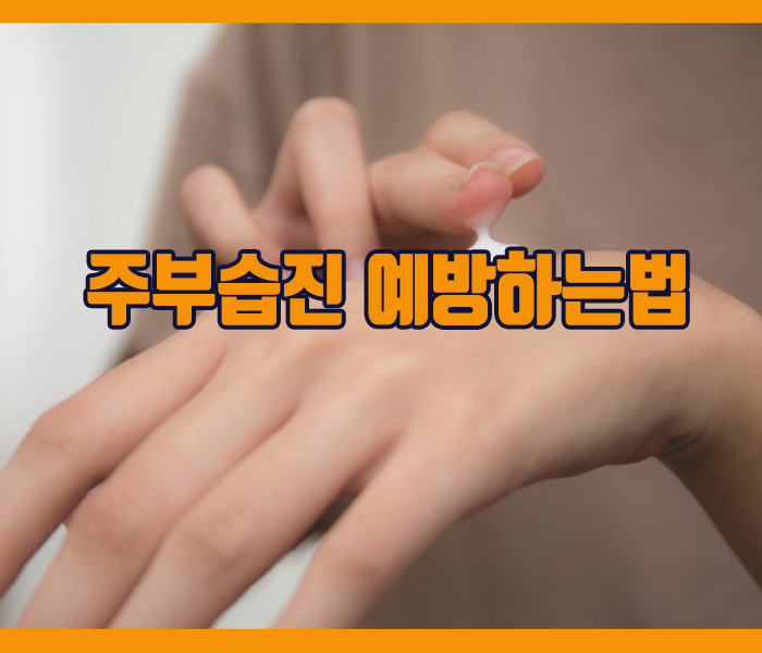 주부습진 예방하는방법 - 지속적인 관리와 생활습관의 변화가 필요