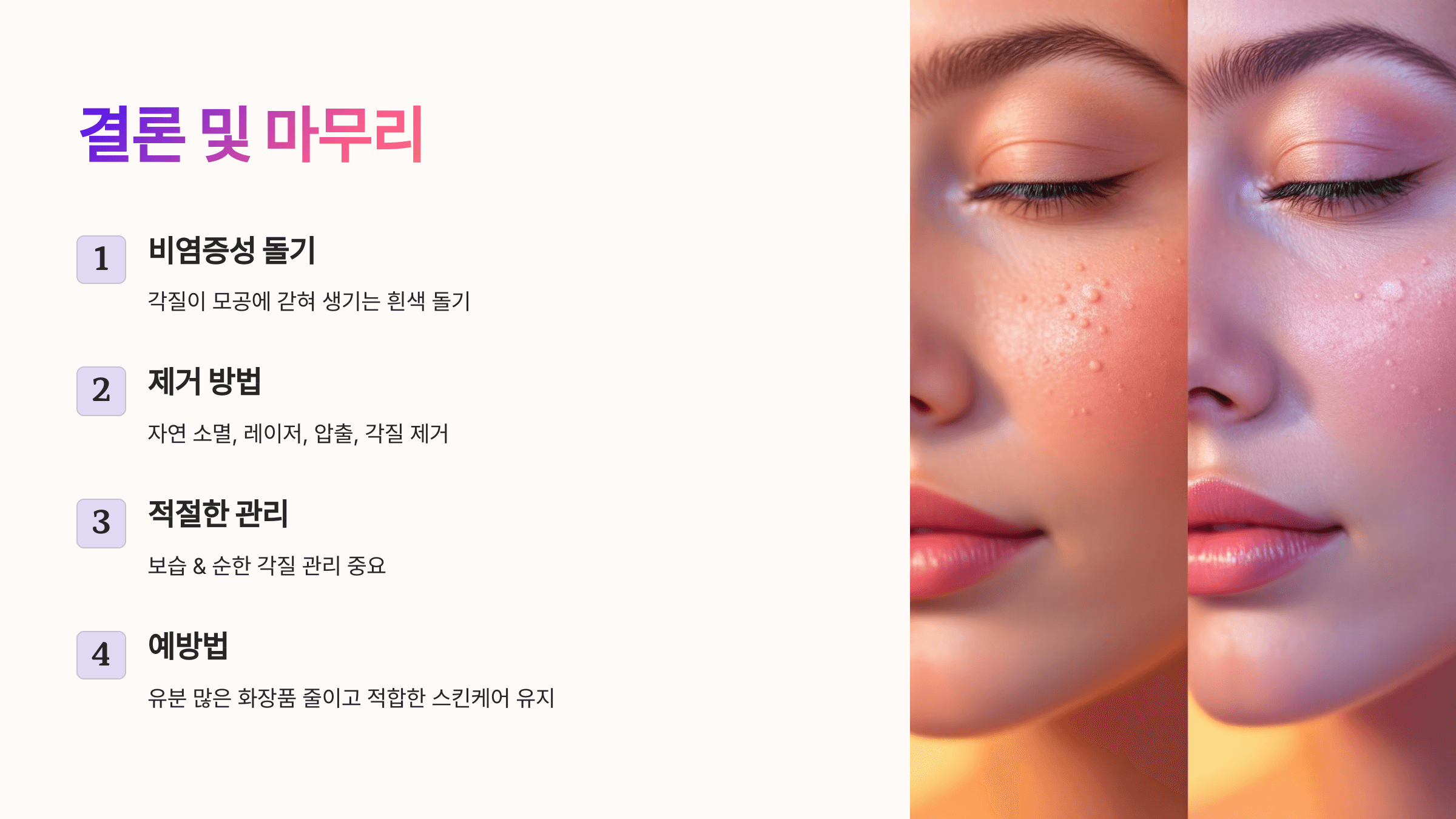 비립종과 관련된 사진입니다.