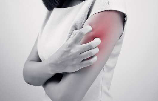 모기 물린데 붓기 빼는법