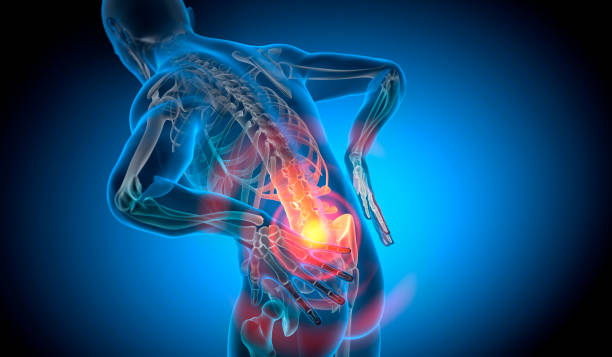 허리디스크 사진