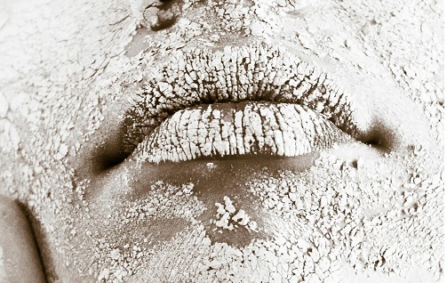 지루 피부염 가설 증상 관리 방법