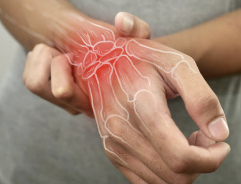 통풍 초기증상 치료법&amp;#44; 좋은 음식에 대한 모든 것 확인