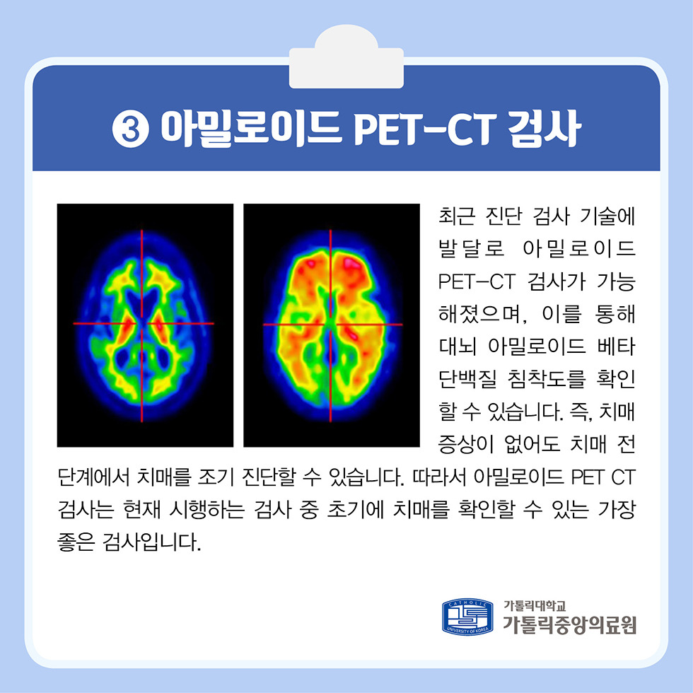 alt="최신진단검사