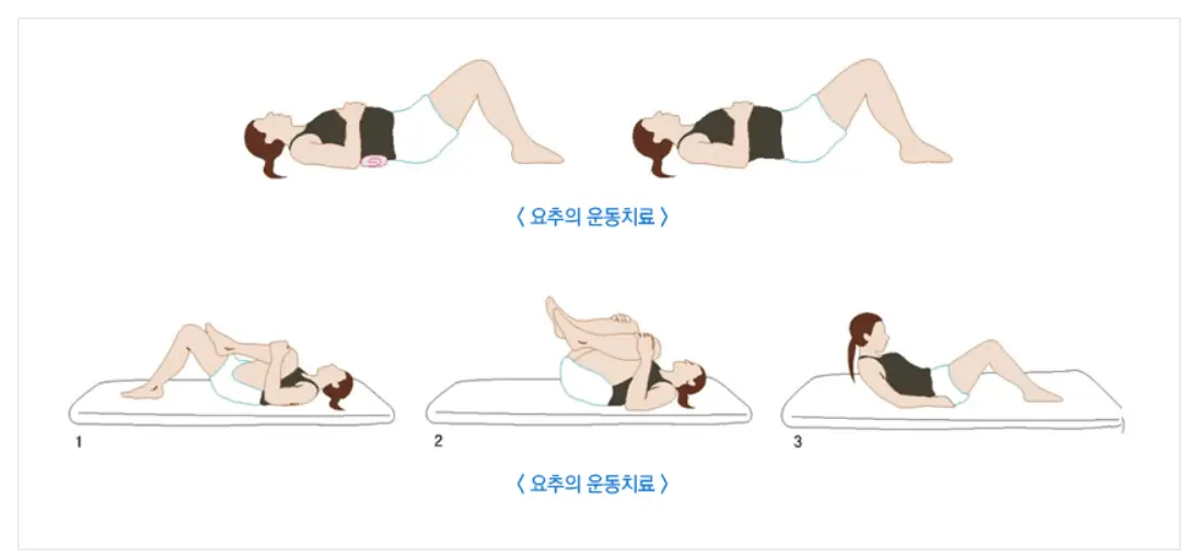 허리통증치료요법