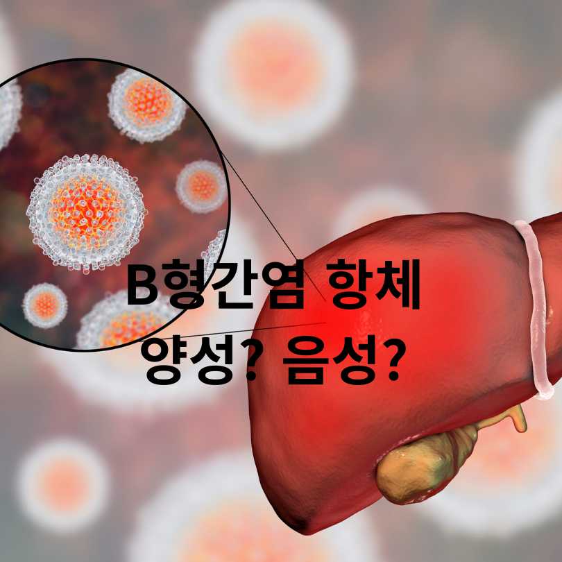 B형간염 항체 양성? 음성?
