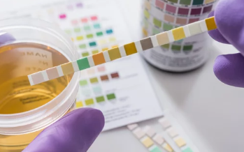 소변 사진/출처:어도비스톡