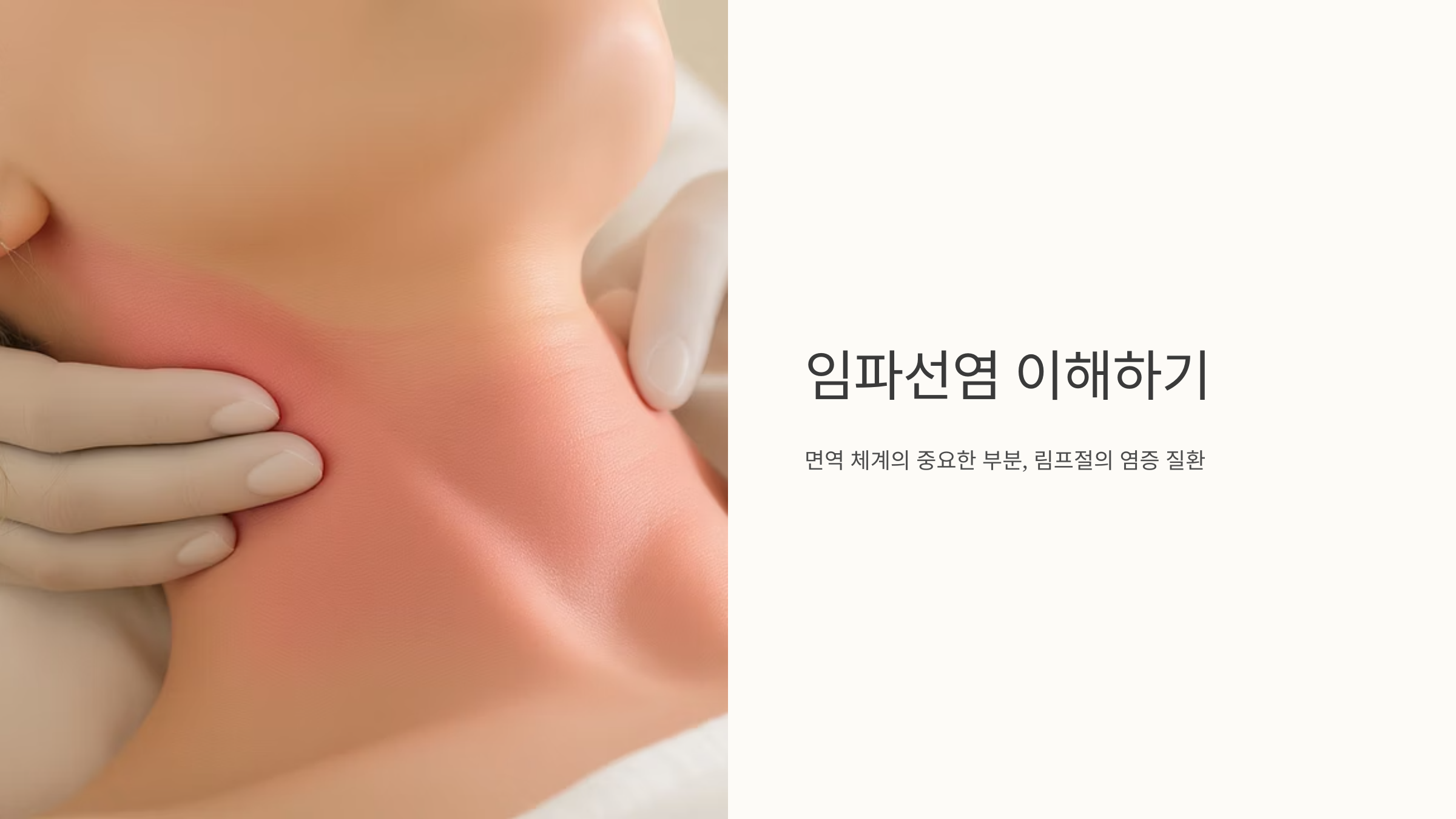 임파선염 증상과 치료 완벽 정리