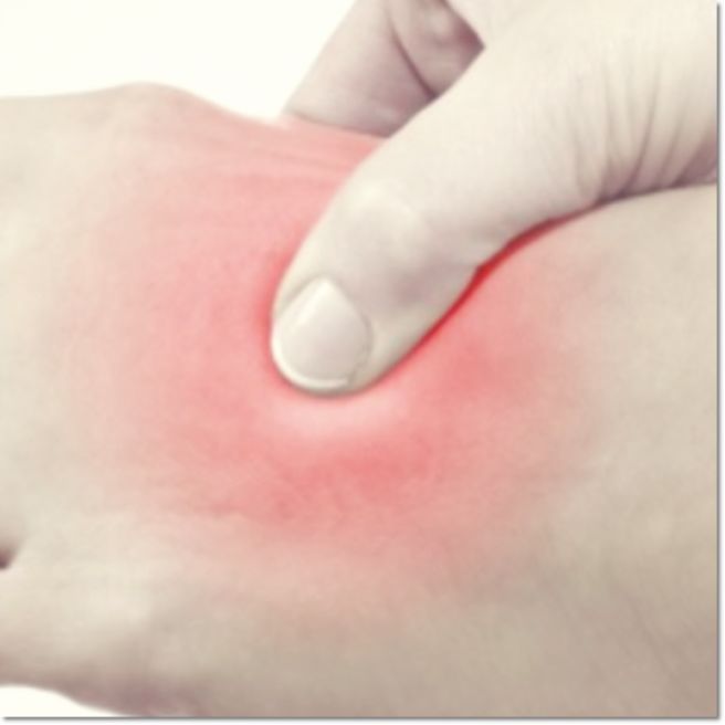 발등이 아픈 이유