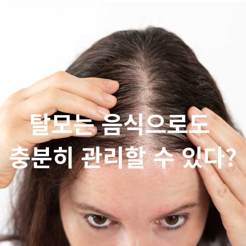 탈모에 좋은 음식 총정리!