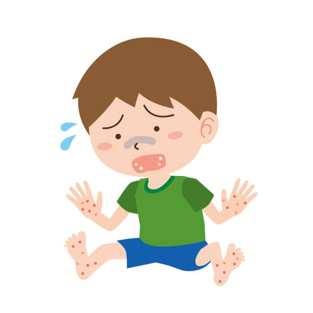 영유아기 수족구병: 전염 경로와 대처법
