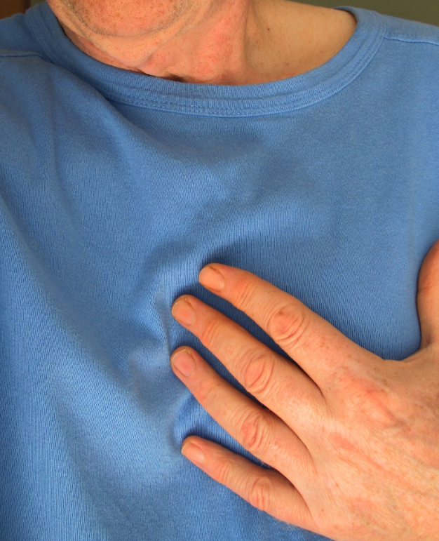 심부정맥혈전증과 관련된 사진2