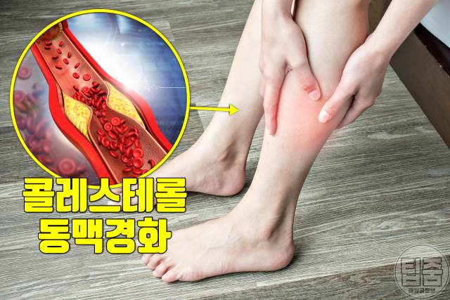 두릅 효능 콜레스테롤 항암 두릅 생으로 먹어도 되나요 두릅부작용