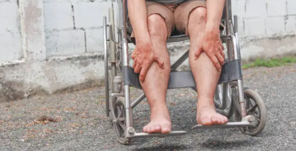 근이영양증과 관련된 사진