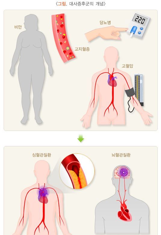 저밀도 콜레스테롤 정상수치