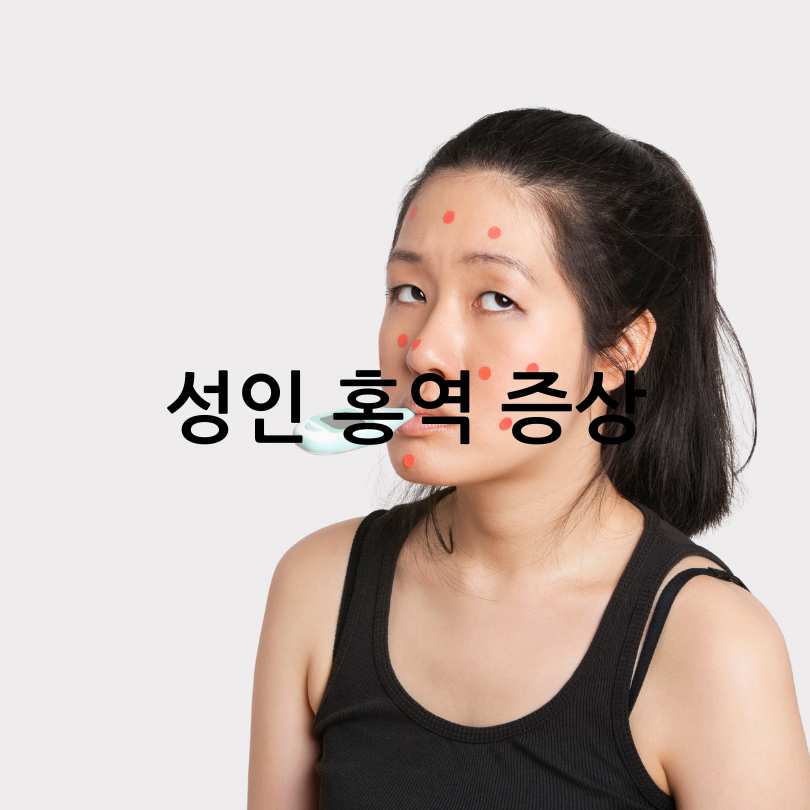성인 홍역과 어린이 홍역의 차이점
