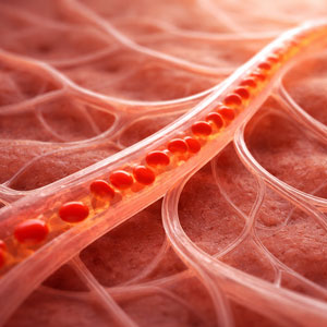 메니에르 병 원인 - 미세혈관 순환 문제
