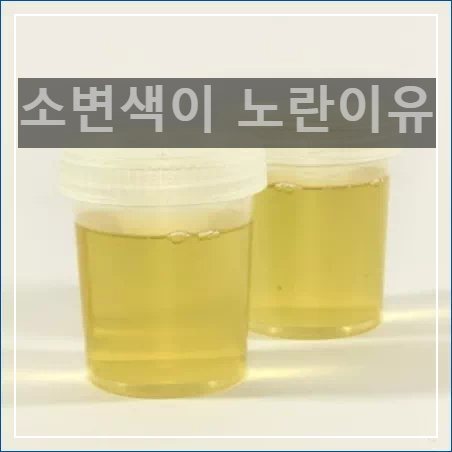 소변색이 노란이유