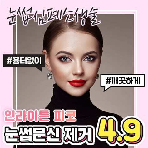 눈비립 종 제거