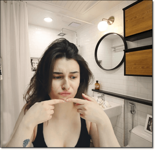 피부염이 있는 여성