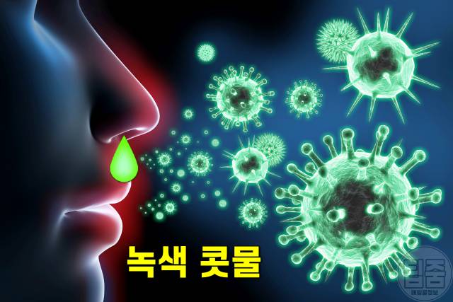콧물 색깔별 증상,녹색 콧물 색깔로 보는 건강,축농증