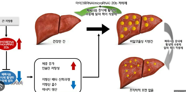 간(8)