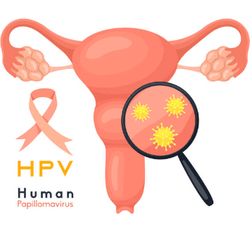 자궁근종 증상 7가지, 수술후 회복기간