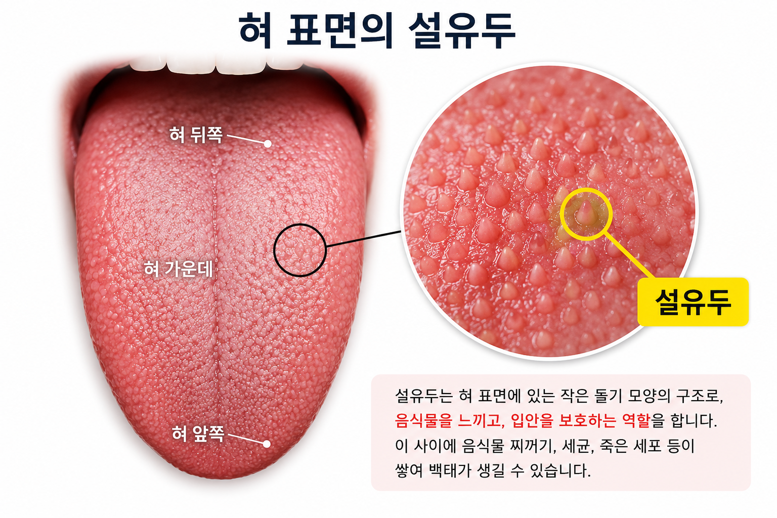 혀 표면의 설유두