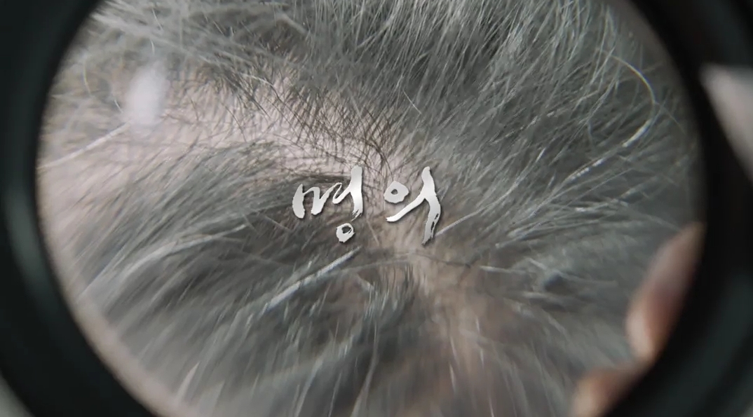 명의 두피질환