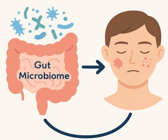 장과 피부의 커넥션