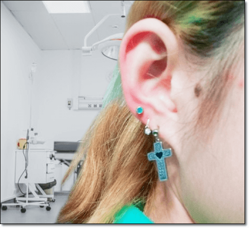 귓볼몽우리 여자