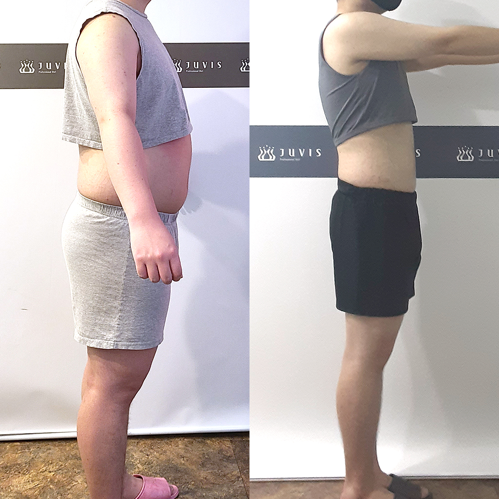 쥬비스-다이어트