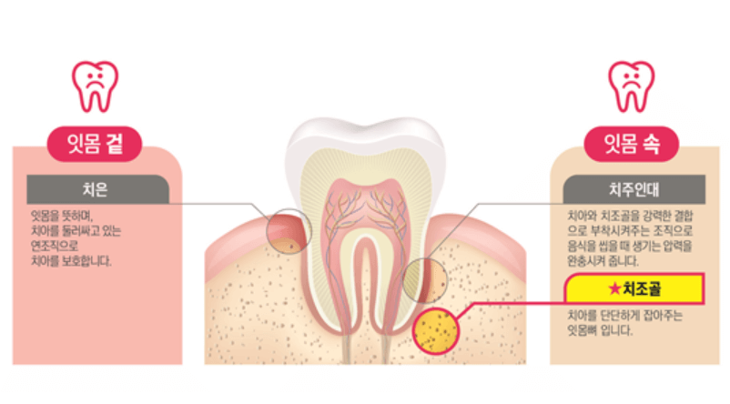 잇몸 조직 사진