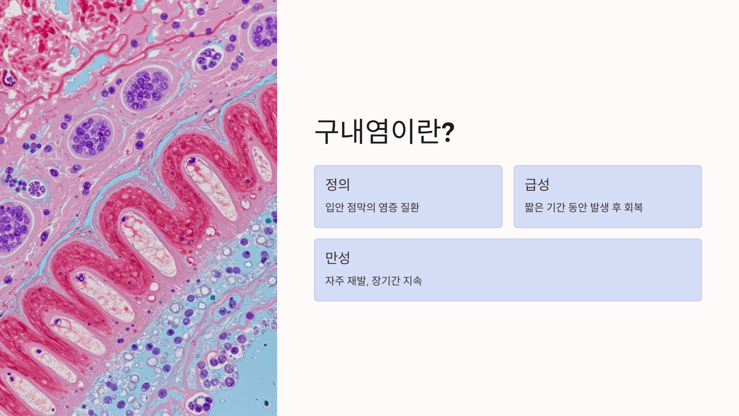 구내염과 관련된 사진입니다.