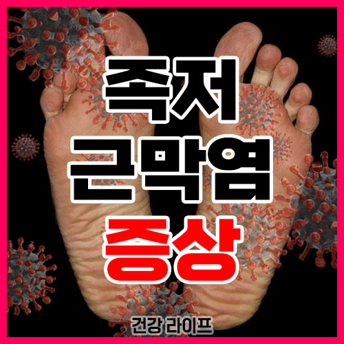 족저 근막염 증상