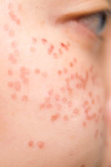 미백 주사 vs 레이저 토닝: 피부 톤 개선에 효과적인 방법 비교