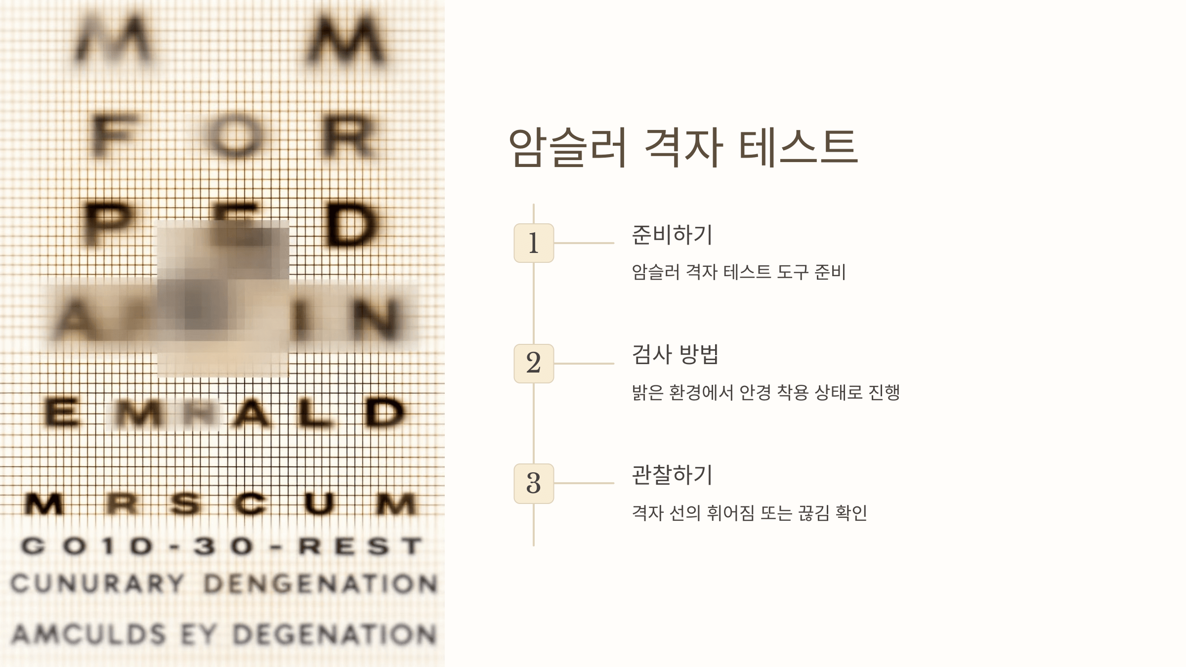 황반변성과 관련된 사진입니다.