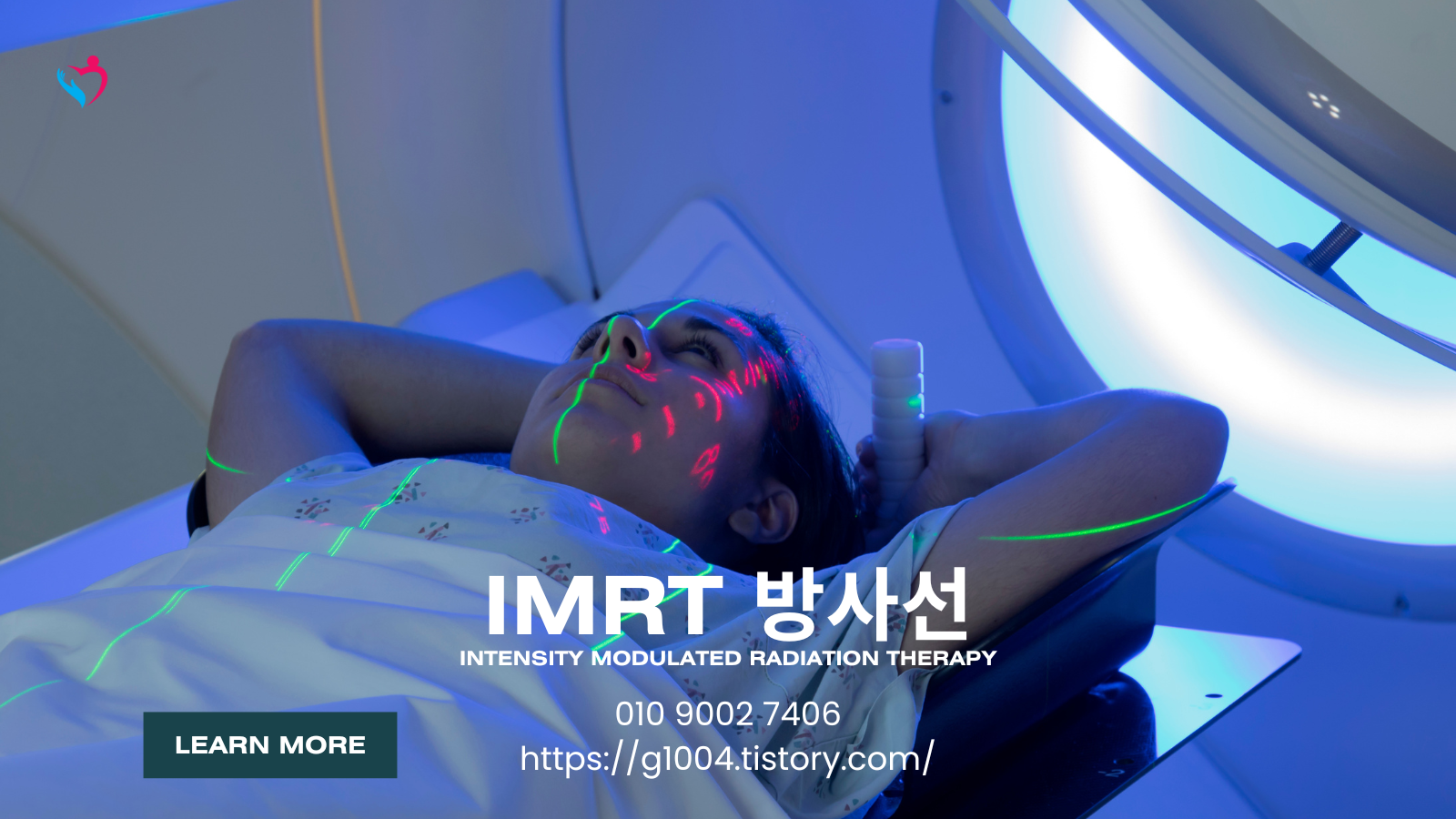 IMRT 방사선