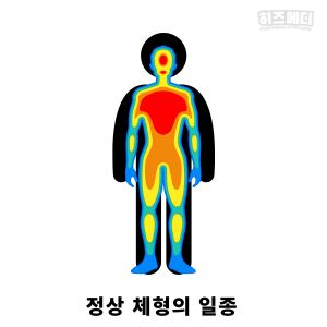 위하수증