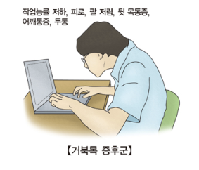 거북목 증후군