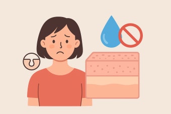 고가 vs 저가 보습제 효과 차이